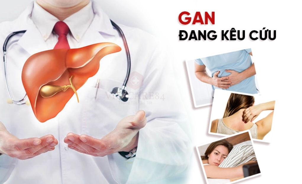 Khi lá gan kêu cứu có biểu hiện gì? Khi lá gan kêu cứu có biểu hiện gì?